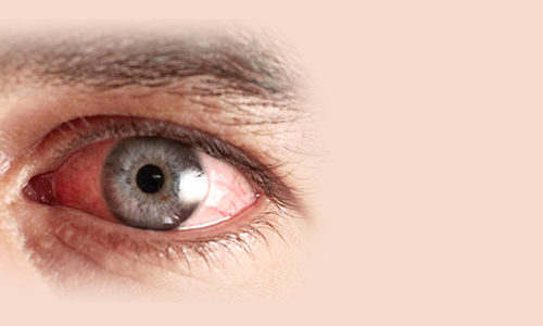 Ocular Disease and Trauma Closeup